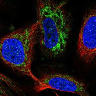 Immunocytochemistry/ Immunofluorescence: FDX1 Antibody [NBP2-38946]