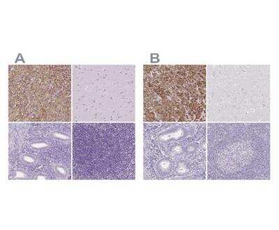 Immunohistochemistry-Paraffin: FDX1 Antibody [NBP1-89227]