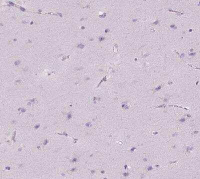 Immunohistochemistry-Paraffin: FDX1 Antibody [NBP1-89227]
