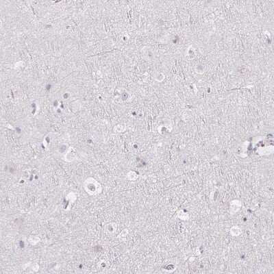 Immunohistochemistry-Paraffin: FDX1 Antibody [NBP2-38946]