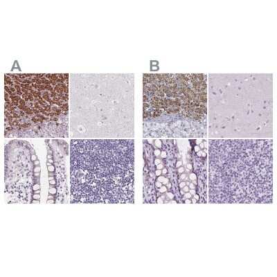 Immunohistochemistry-Paraffin: FDX1 Antibody [NBP2-38946]