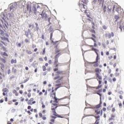 Immunohistochemistry-Paraffin: FDX1 Antibody [NBP2-38946]