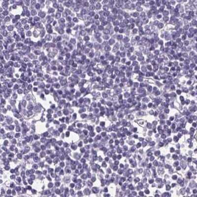 Immunohistochemistry-Paraffin: FDX1 Antibody [NBP2-38946]