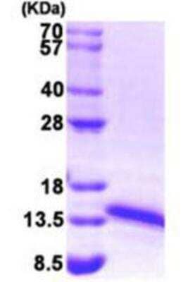 SDS-PAGE: Recombinant Human FDX1 His-T7 Protein [NBP1-50829]