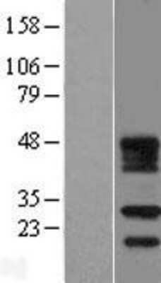 Western Blot: FDX1L Overexpression Lysate [NBL1-10671]