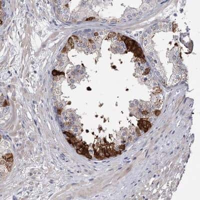 Immunohistochemistry: FDXACB1 Antibody [NBP1-90460]