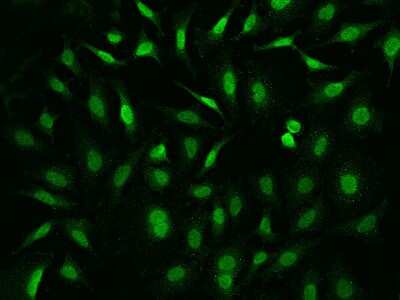 Immunocytochemistry/ Immunofluorescence: FE65 Antibody [NBP2-99557]