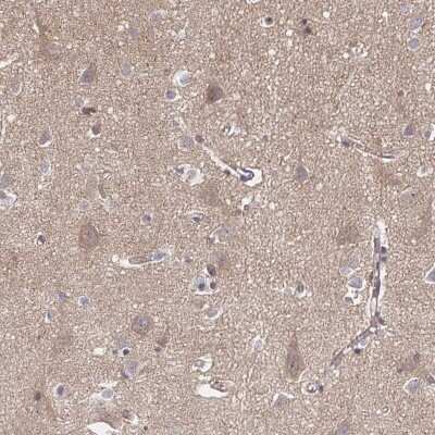 Immunohistochemistry-Paraffin: FE65 Antibody [NBP2-48682]