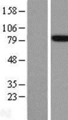 Western Blot: FE65 Overexpression Lysate [NBL1-07591]