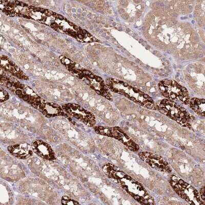 Immunohistochemistry-Paraffin: FECH Antibody [NBP2-33413]