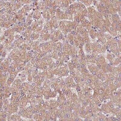 Immunohistochemistry-Paraffin: FECH Antibody [NBP2-33413]