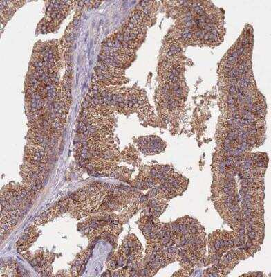 Immunohistochemistry-Paraffin: FECH Antibody [NBP2-33413]