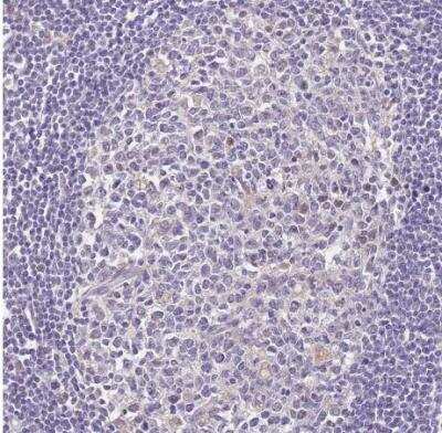 Immunohistochemistry-Paraffin: FECH Antibody [NBP2-33413]