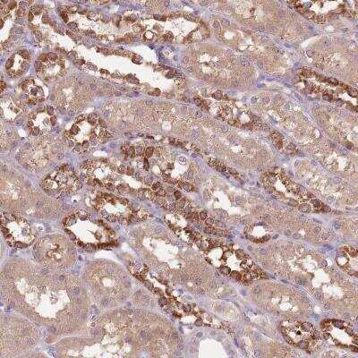 Immunohistochemistry-Paraffin: FECH Antibody [NBP2-33517]