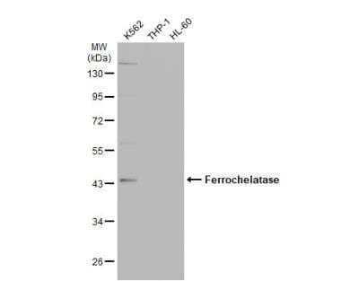 Western Blot: FECH Antibody [NBP1-31765]