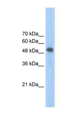 Western Blot: FECH Antibody [NBP1-54840]