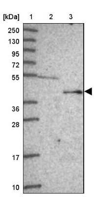 Western Blot: FECH Antibody [NBP2-33413]