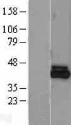 Western Blot: FECH Overexpression Lysate [NBL1-10673]