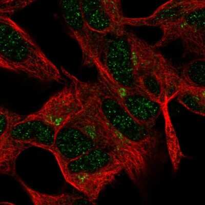 Immunocytochemistry/ Immunofluorescence: FEM1A Antibody [NBP2-57434]