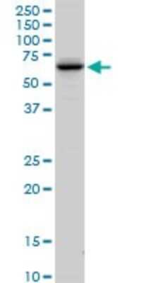 Western Blot: FEM1A Antibody [H00055527-D01P]