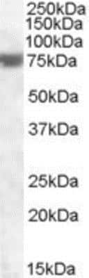 Western Blot: FEM1A Antibody [NBP1-36956]