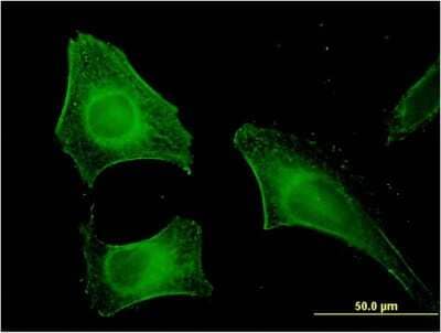 Immunocytochemistry/ Immunofluorescence: FEM1B Antibody (4B12) [H00010116-M09]