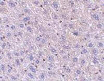 Immunohistochemistry-Paraffin: FEM1B Antibody - BSA Free [NBP1-77300]