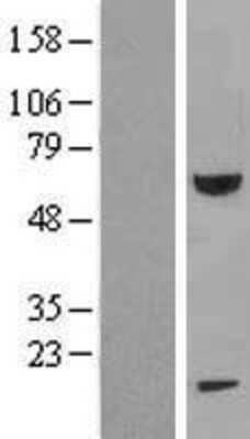 Western Blot: FEM1B Overexpression Lysate [NBL1-10674]