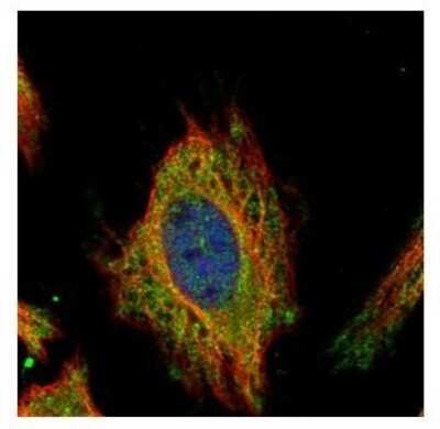Immunocytochemistry/ Immunofluorescence: FEM1C Antibody [NBP2-14955]