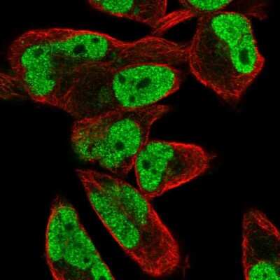 Immunocytochemistry/ Immunofluorescence: FEM1C Antibody [NBP2-32501]