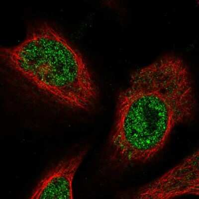 Immunocytochemistry/ Immunofluorescence: FEM1C Antibody [NBP2-57473]