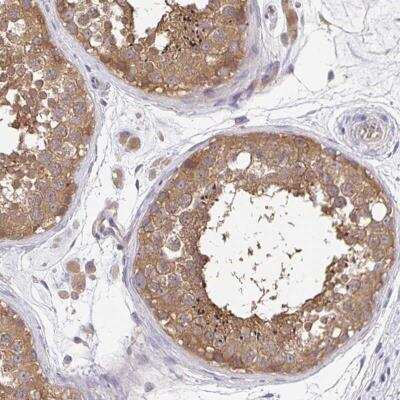 Immunohistochemistry-Paraffin: FEM1C Antibody [NBP2-32501]