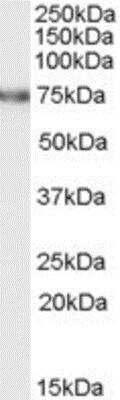Western Blot: FEM1C Antibody [NB100-784]