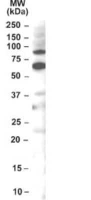 Western Blot: FEM1C Antibody [NB100-784]