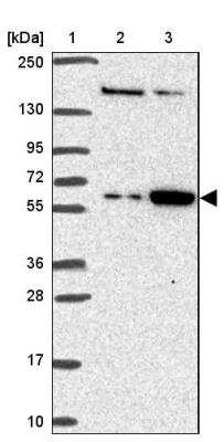 Western Blot: FEM1C Antibody [NBP2-32501]