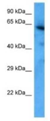 Western Blot: FEM1C Antibody [NBP3-10012]