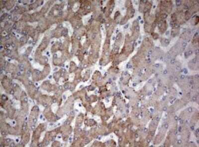 Immunohistochemistry: FEN-1 Antibody (OTI1F3) [NBP2-45640]