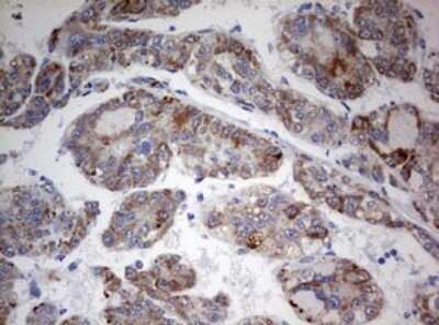 Immunohistochemistry: FEN-1 Antibody (OTI1F3) [NBP2-45640]