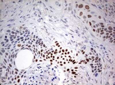 Immunohistochemistry: FEN-1 Antibody (OTI1F3) [NBP2-45640]