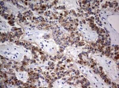 Immunohistochemistry: FEN-1 Antibody (OTI1F3) [NBP2-45640]