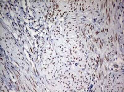 Immunohistochemistry: FEN-1 Antibody (OTI1F3) [NBP2-45640]