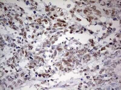 Immunohistochemistry: FEN-1 Antibody (OTI1F3) [NBP2-45640]