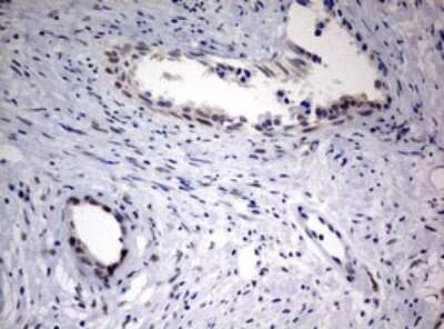 Immunohistochemistry: FEN-1 Antibody (OTI1F3) [NBP2-45640]