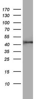 Western Blot: FEN-1 Antibody (OTI1F3) [NBP2-45640]