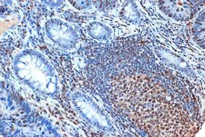 Immunohistochemistry-Paraffin: FEN-1 Antibody (3H9L9) [NBP3-16730]