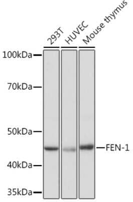 Western Blot: FEN-1 Antibody (3H9L9) [NBP3-16730]