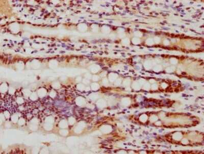 Immunohistochemistry: FEN-1 Antibody (4D9) [NBP3-15190]