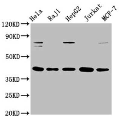 Western Blot: FEN-1 Antibody (4D9) [NBP3-15190]