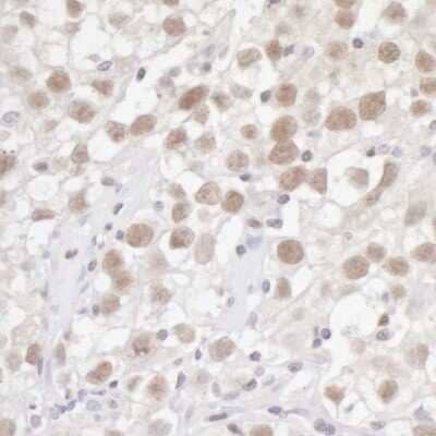 Immunohistochemistry-Paraffin: FEN-1 Antibody [NB100-321]