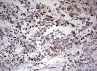 Immunohistochemistry: FEN-1 Antibody (OTI1F3) - Azide and BSA Free [NBP2-70716]